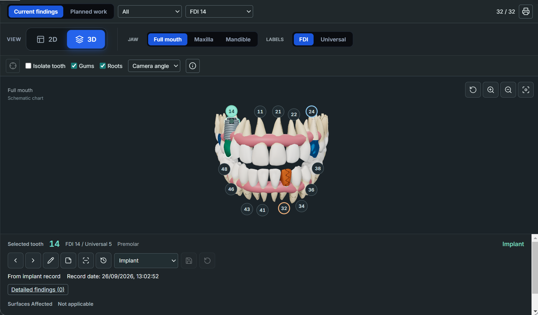 Interactive 3D tooth chart with selected tooth details